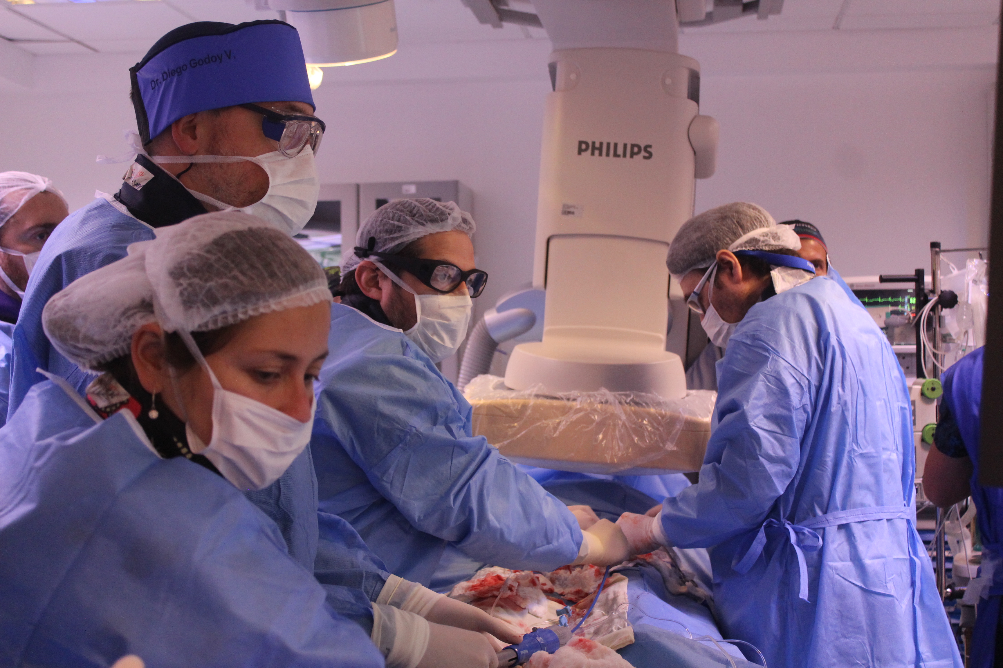 Por primera vez se realiza una cirugía de implante valvular aórtico vía percutánea en el Hospital Clínico Magallanes