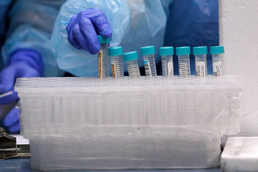 Organización Panamericana de la Salud, OPS, estudiará muestras de Covid-19 en Magallanes y analizará mutación