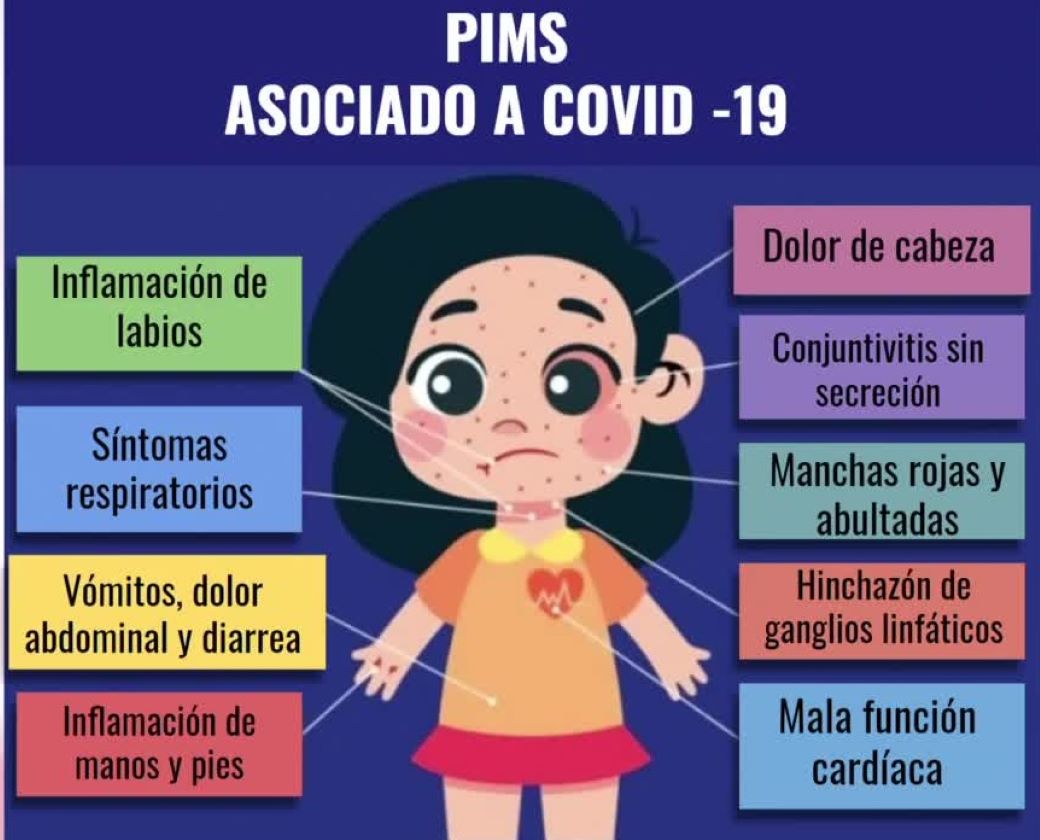 Síntomas del PIMS puede presentarse 4 semanas después de contraer COVID: especialista entrega tips para prevenirlo