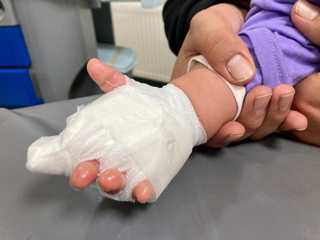 Profesionales HCM efectúan llamado a prevención de accidentes domésticos en menores