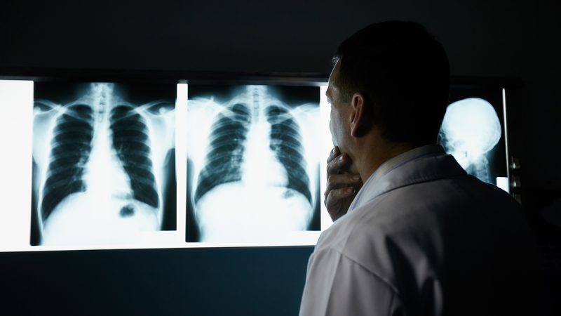 Proyecto que detecta hallazgos críticos en radiografías ganó concurso de emprendimientos Brain Chile 2021