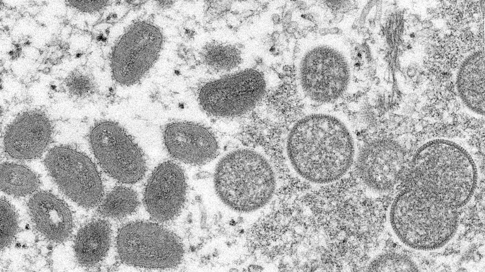 Colegio Médico Veterinario informa sobre virus denominado Viruela del Mono