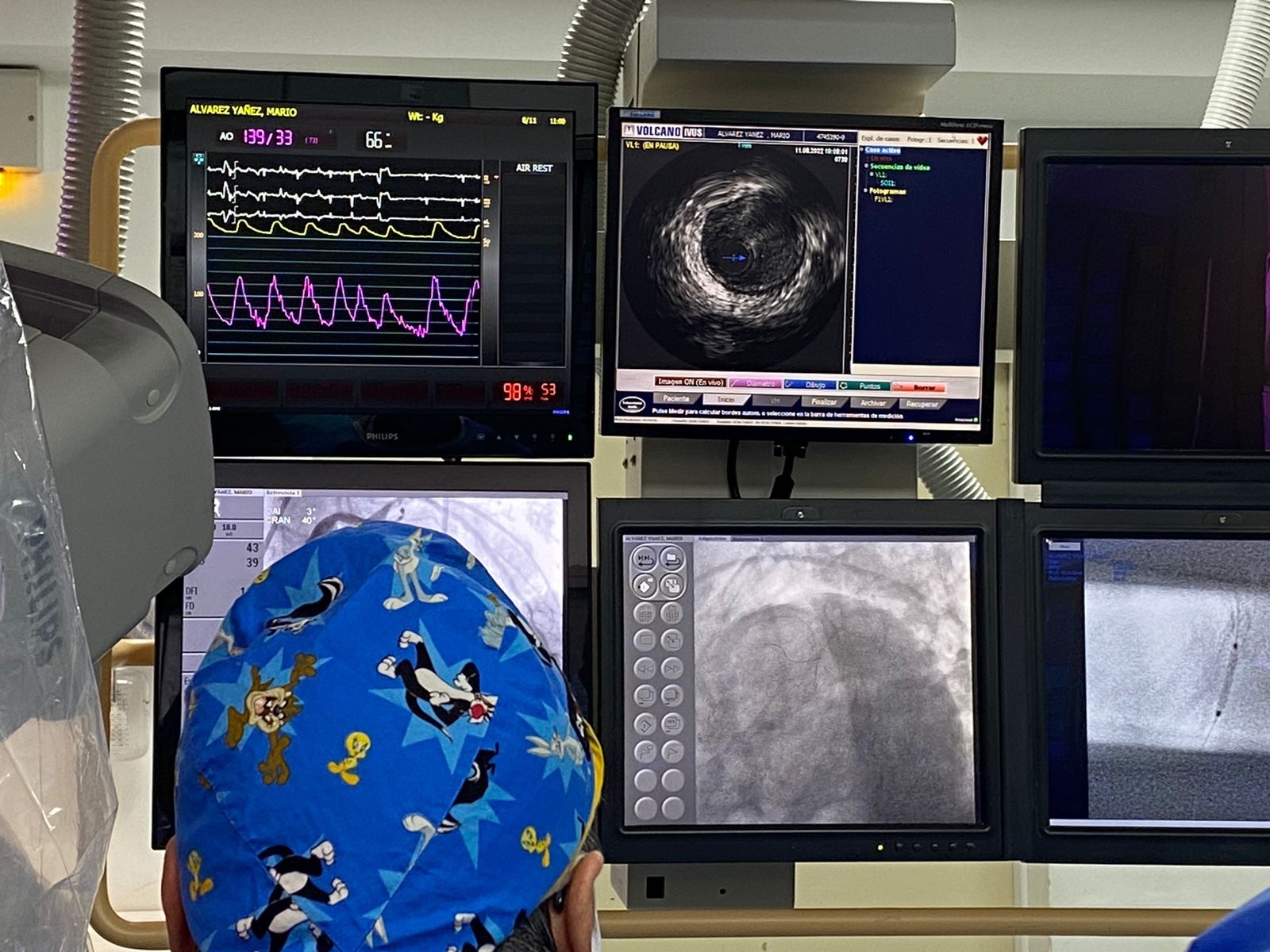 Nuevas técnicas se implementan para procedimientos de Angioplastias en Magallanes