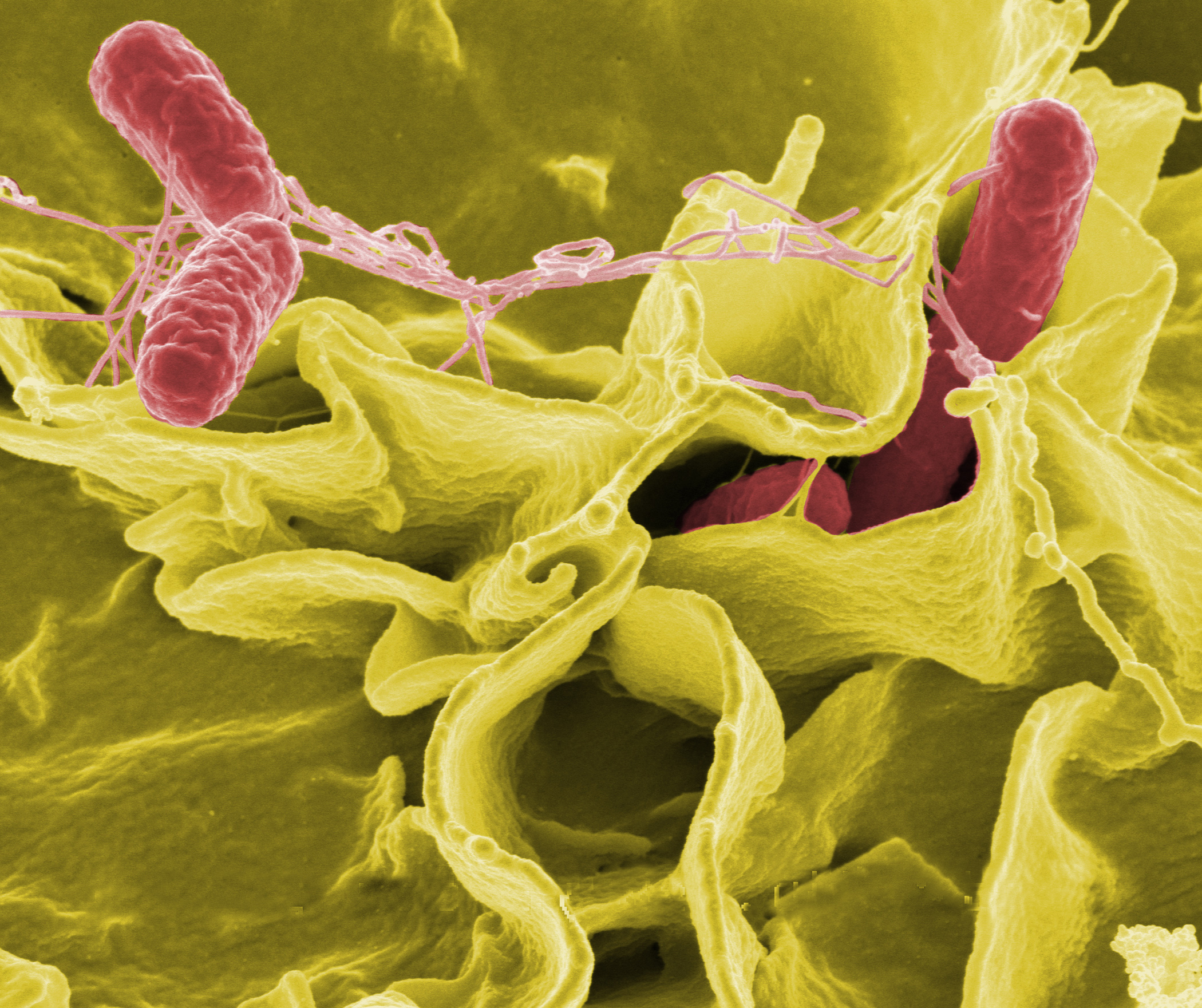 SEREMI de Salud detecta aumento de casos de salmonella y brote en un local de venta de sushi en Punta Arenas