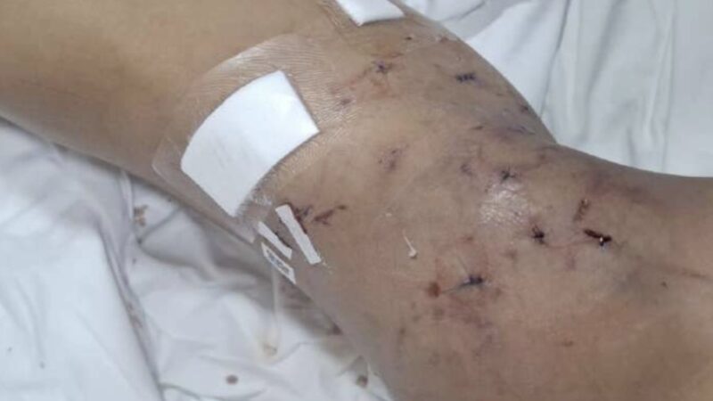 Jauría de seis perros ataca brutalmente a niño en sector periurbano de Punta Arenas